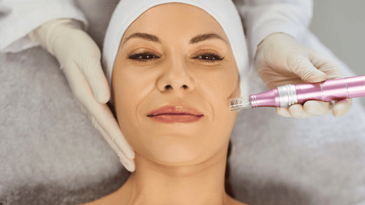 Ansiktsbehandling med microneedling utförd av hudterapeut, exempel på professionell behandling där microneedling inte ska göras vid infektion, inflammation eller aktiv hudsjukdom